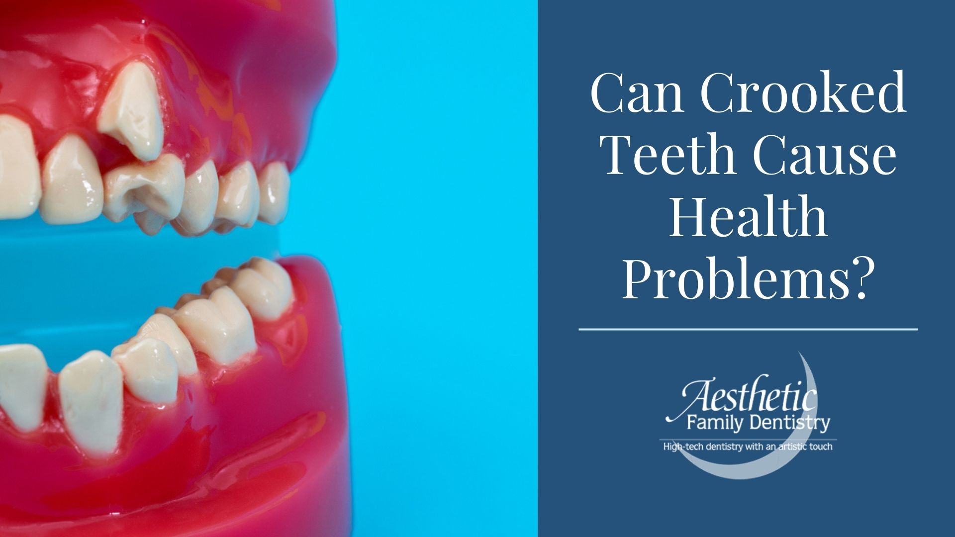 Can Crooked Teeth Cause Health Problems 9556